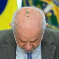 Lula se diz curado de câncer de pele após 15 sessões de radioterapia imagem