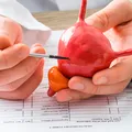 Novo tratamento reduz em 60% o risco de retorno do câncer imagem