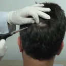 Exame toxicológico da CNH: após polêmicas, saiba quanto do cabelo é cortado