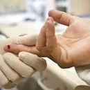HIV terá maioria de pacientes acima dos 50 anos até 2040