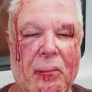 Idoso militante do PT é agredido e motivação política é investigada