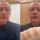 Jornalista da Globo é atacado por pitbull e mostra ferimentos; assista