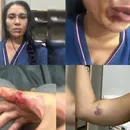 Juiz afasta tentativa de feminicídio após mulher ser esganada e agredida