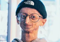 Aos 28 anos, morre influenciador com doença genética rara