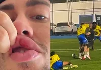 Cantor critica ex-jogador do Bahia após apanhar em jogo festivo; veja