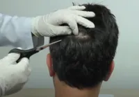 Exame toxicológico da CNH: após polêmicas, saiba quanto do cabelo é cortado