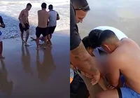 Jovem é atacada por tubarão e tem perna devorada