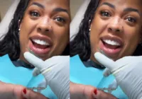 Marvvila realiza cirurgia para tirar sexto dedo: "Tchau sem vergonha" imagem