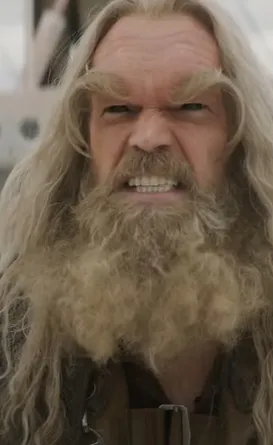 É possível? Ator de X-Men é diagnosticado com câncer de mama; confira