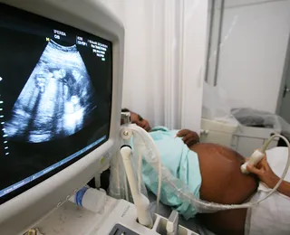 Aborto espontâneo: por que acontece e quando investigar?