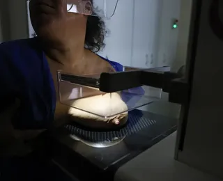 ANS propõe ampliação de mamografia digital nos planos de saúde