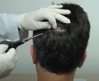 Exame toxicológico da CNH: após polêmicas, saiba quanto do cabelo é cortado