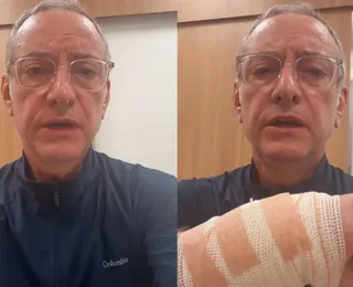 Jornalista da Globo é atacado por pitbull e mostra ferimentos; assista