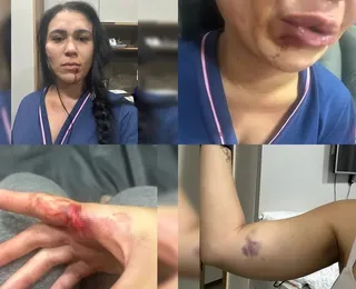 Juiz afasta tentativa de feminicídio após mulher ser esganada e agredida