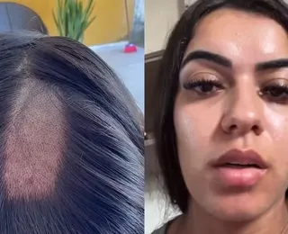 Mulher tem cabelo raspado em exame toxicológico para CNH