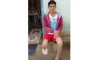 Homem que amputou o próprio pé havia feito quatro seguros dias antes da fraude