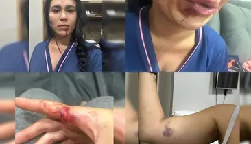 Juiz afasta tentativa de feminicídio após mulher ser esganada e agredida