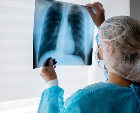 Câncer de pulmão pode ter até 95% de cura; conheça sinais de alerta