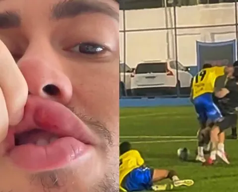 Cantor critica ex-jogador do Bahia após apanhar em jogo festivo; veja - Imagem