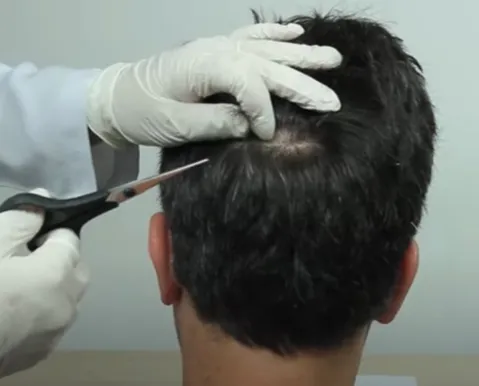 Exame toxicológico da CNH: após polêmicas, saiba quanto do cabelo é cortado