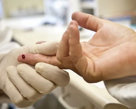 HIV terá maioria de pacientes acima dos 50 anos até 2040