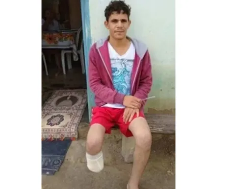 Homem que amputou o próprio pé havia feito quatro seguros dias antes da fraude