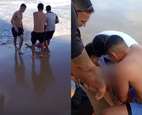 Jovem é atacada por tubarão e tem perna devorada - Imagem
