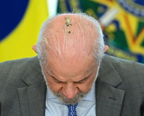 Lula se diz curado de câncer de pele após 15 sessões de radioterapia - Imagem