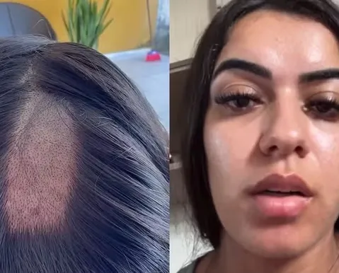 Mulher tem cabelo raspado em exame toxicológico para CNH