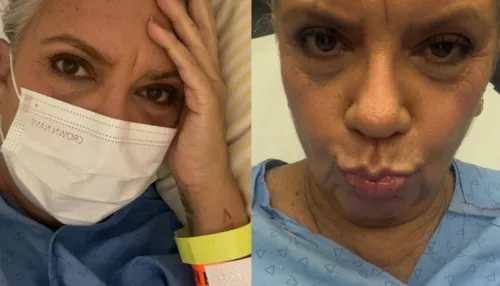 Astrid Fontenelle vai parar no hospital após engolir espinha de peixe
