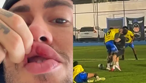 Cantor critica ex-jogador do Bahia após apanhar em jogo festivo; veja