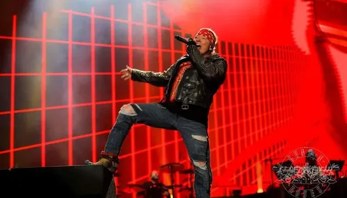 Vocalista do Guns N' Roses revela problema de saúde que surge ao cantar