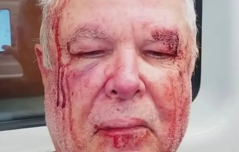 Idoso militante do PT é agredido e motivação política é investigada