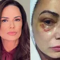 Luiza Brunet detona condenação de ex por agressão imagem