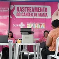 Outubro Rosa: agendamento para mamografias segue em andamento pelo SUS imagem