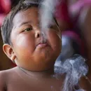 Menino que fumava 40 cigarros por dia aos 2 anos surge irreconhecível