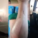 Ônibus atravessa rodovia em meio a incêndio e deixa 19 pessoas feridas na BA