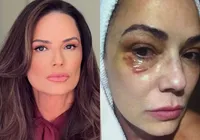Luiza Brunet detona condenação de ex por agressão
