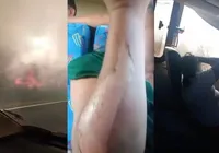 Ônibus atravessa rodovia em meio a incêndio e deixa 19 pessoas feridas na BA