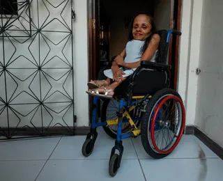 Aos 60, psicóloga com ossos de vidro conta como superou fraturas e preconceito