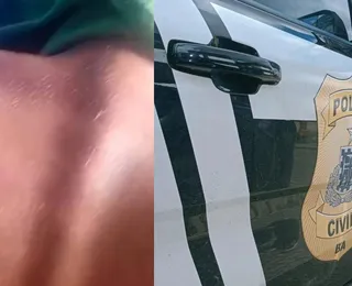 Criança de 8 anos é agredida com cipó pelo professor na Bahia