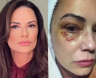 Luiza Brunet detona condenação de ex por agressão