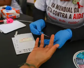 PrEP contra HIV aplicada 2 vezes ao ano chega ao Brasil