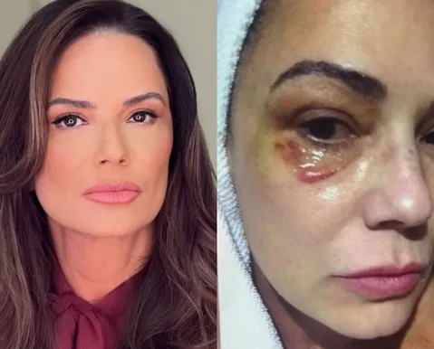 Luiza Brunet detona condenação de ex por agressão