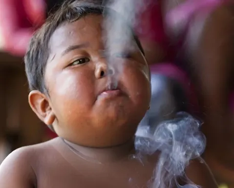 Menino que fumava 40 cigarros por dia aos 2 anos surge irreconhecível