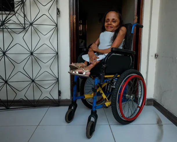 Aos 60, psicóloga com ossos de vidro conta como superou fraturas e preconceito