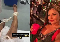 Advogada acusada de morder pessoas na Sapucaí desabafa: 'Legítima defesa' imagem