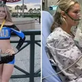 Jovem desenvolve doença pulmonar após fumar cigarro eletrônico imagem