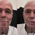 Vídeo: Netinho mostra efeitos colaterais durante tratamento imagem