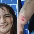 Revolta com traição, mulher ataca marido com mordidas e acaba presa imagem